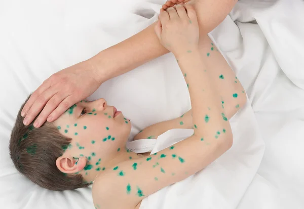 Sick boy in white bed — Stock Photo, Image