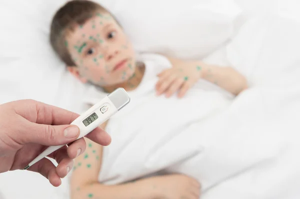 Medição de temperatura menino doente na cama — Fotografia de Stock