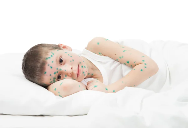 Niño enfermo en la cama blanca — Foto de Stock