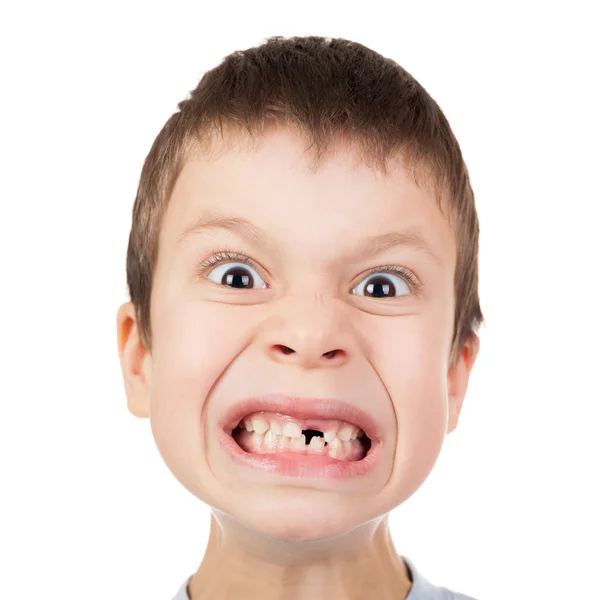 Pojke face närbild med en förlorad tand — Stockfoto