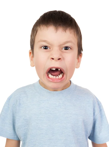 Boy with a lost tooth grimacing — Stock Photo, Image