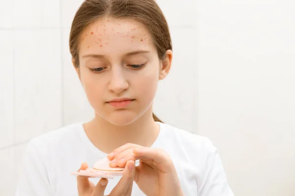 Cara Una Adolescente Mira Espejo Cuida Piel Hace Procedimientos Cosméticos — Foto de Stock