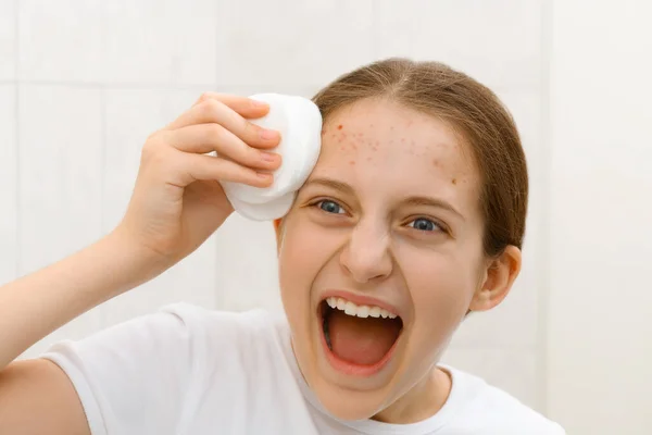 Rosto Uma Adolescente Gritando Com Acnes Ela Olha Para Mesma — Fotografia de Stock