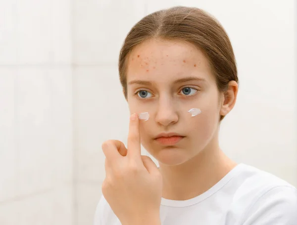 girl puts cream on her face, face of a teenage girl with pimples, acne on the skin, she looks at herself in the mirror, concept of beauty and health