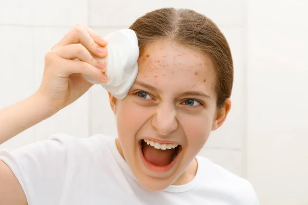 10代の女の子の顔ににきびがあり鏡を見て肌の世話をし綿のパッドを使用して化粧品の手順を行います非常に感情的な優雅 — ストック写真