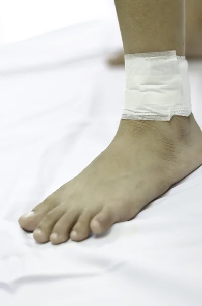 白い包帯で包まれた子供の足首 — ストック写真