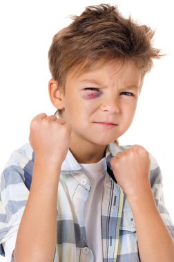 Boy with bruise clipart