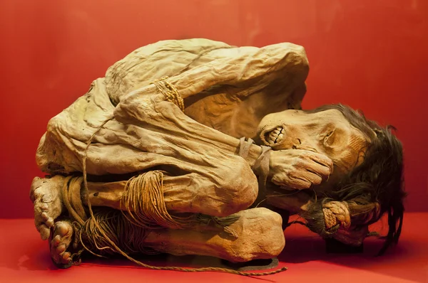 Pessoa morta do Museu Wellcome — Fotografia de Stock