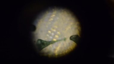 Stentor Polymorphus