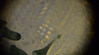 Stentor Polymorphus