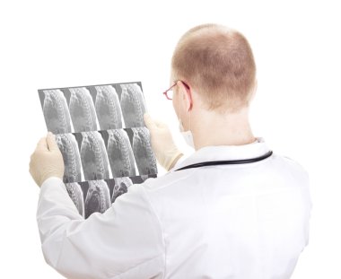 Medical doctor with radiograph clipart