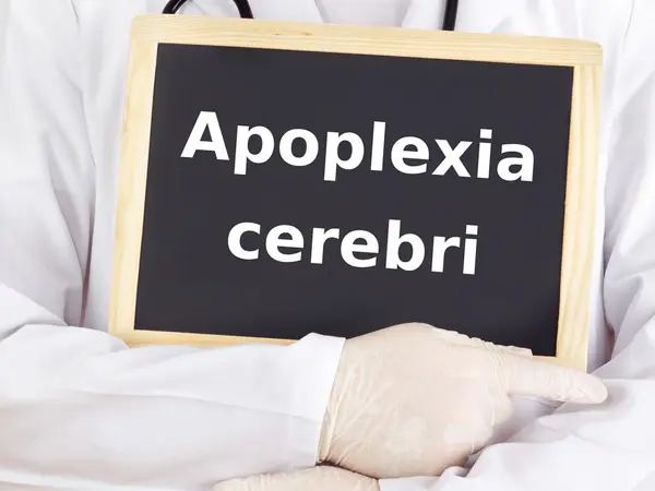 Doktor bilgileri gösterir: serebrovasküler — Stok fotoğraf