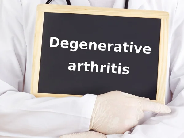 Arzt zeigt Informationen: degenerative Arthritis — Stockfoto