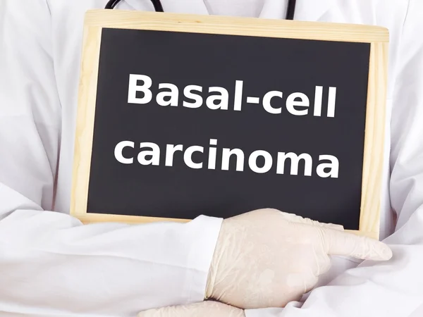 O médico mostra informações: carcinoma basocelular — Fotografia de Stock