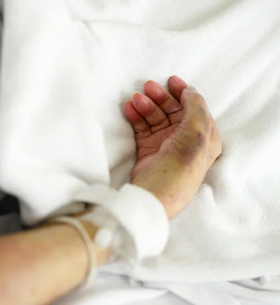 Dłoń pacjenta — Zdjęcie stockowe