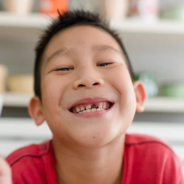 Pequeño asiático chico y roto dientes . — Foto de Stock