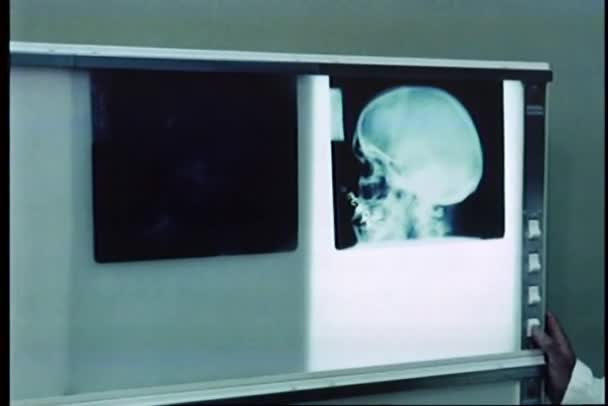 Doctor reviewing roentgenograms of skull on lightbox — Stock Video