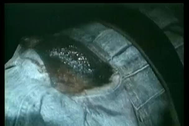 Yakın-up el turnike yara çevresinde bacak yukarıda tespit etmek — Stok video