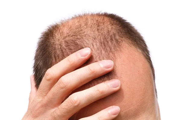 Stressed man — Stock Photo, Image