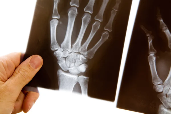 Doctor with x-ray of hand — Stock Photo, Image