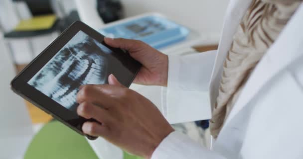 Biracial Dentista Feminino Examinando Dentes Tablet Clínica Odontológica Moderna Serviços — Vídeo de Stock
