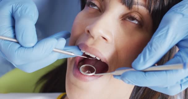 現代の歯科クリニックで女性患者の歯を調べる男性歯科医の手 歯科事業 — ストック動画