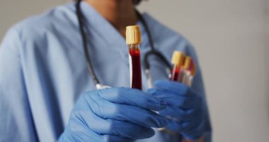 Mavi arka planda test tüpleri tutan melez kadın doktorların videosu. küresel tıp ve sağlık konsepti.