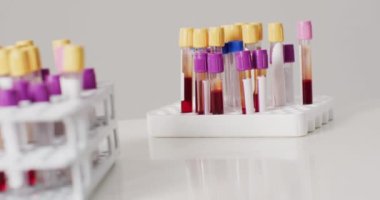 Beyaz arka planda test tüplerinin yakın çekim videosu. küresel tıp ve sağlık konsepti.