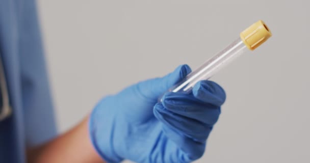 Video Biracial Female Doctor Holding Test Tube Blue Background Global — Stok video