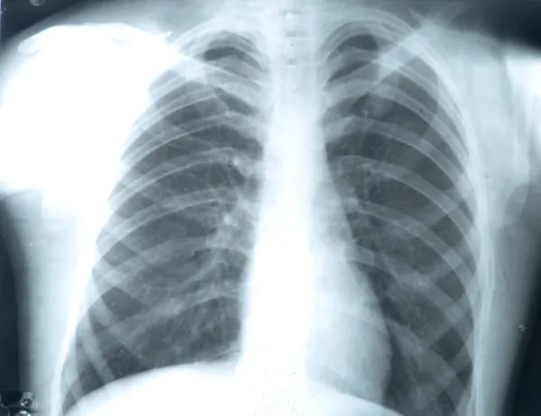 Fluorography — 스톡 사진