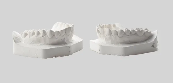 Çenenin alçı modeli