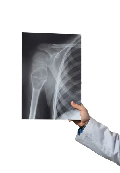 Doktor hastanın x-ray ele alıyor. — Stok fotoğraf