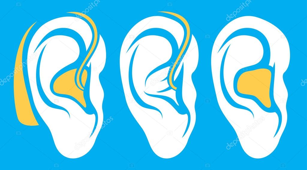 Hearing aid on white ear