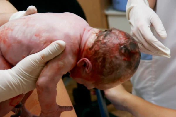 Gros plan du bébé qui vient de naître entre les mains du médecin — Photo