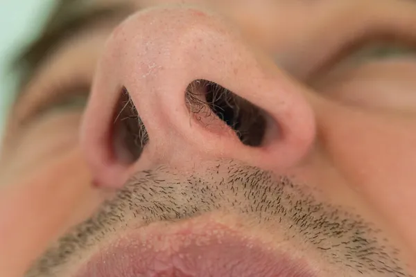 Caucasian male unkempt nose hair follicles macro close up shot. Close up shot, unrecognizable.