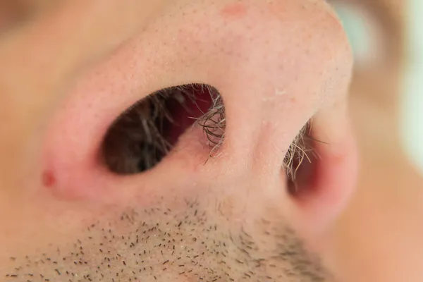 Caucasian male unkempt nose hair follicles macro close up shot. Close up shot, unrecognizable.