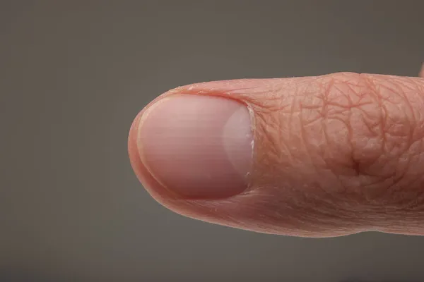 Белый Мужчина Большой Палец Макро Ногтей Закрыть Студийный Снимок Изолированный — стоковое фото
