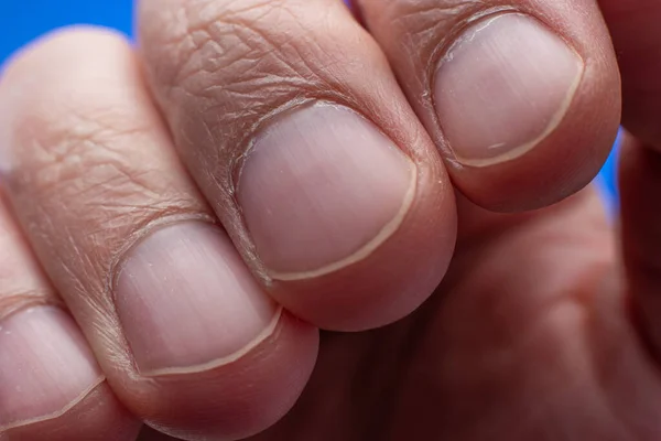 Dedos Masculinos Unhas Macro Close Shot Estúdio Filmado Sem Pessoas — Fotografia de Stock