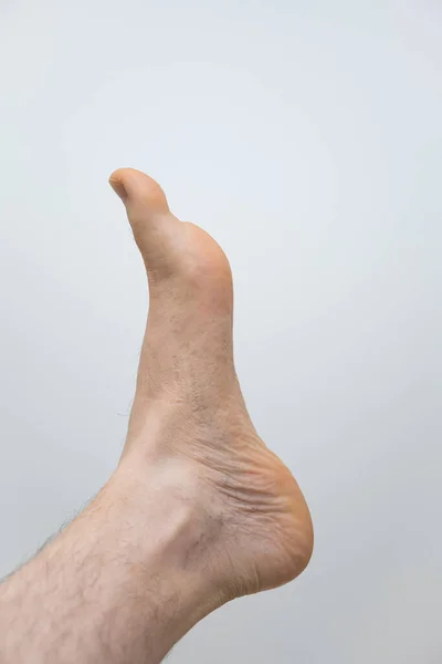 Caucasian Male Bare Foot Isolated White Background Close Front Shot — Stockfoto