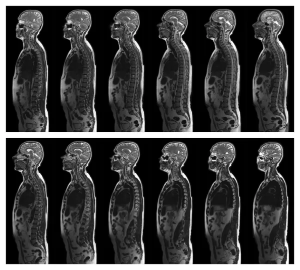 MRI scan — Stock Image MRI scan Stock Picture