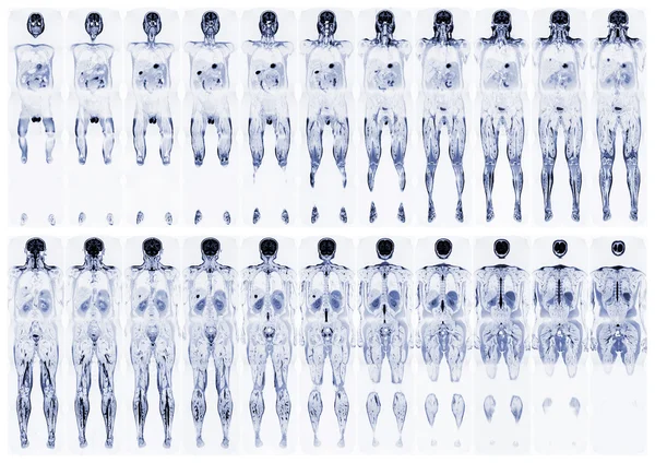 Сканируйте человеческое тело — стоковое фото