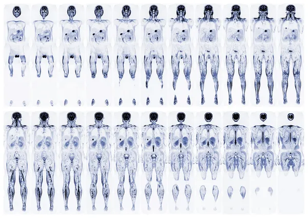 Scan the human body — Stock Image Scan the human body Stock Picture