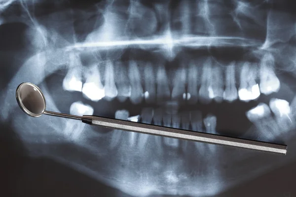 X-ray scan of humans teeth — Stock Photo, Image