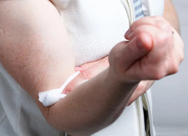 Appying a swab to an arm after blood sample — Stock Photo, Image