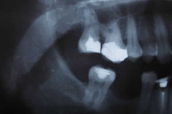Insanlar diş röntgeni tarama — Stok fotoğraf