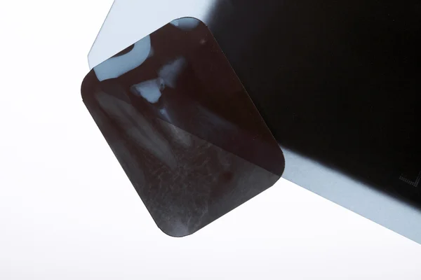 Tandheelkundige x-ray film detail — Stockfoto
