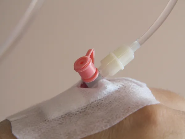 Patient's hand in the hospital with an IV — Stock Photo, Image