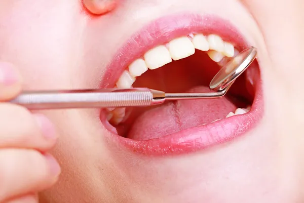 Close-up of young female having her teeth examinated — Stock Photo, Image