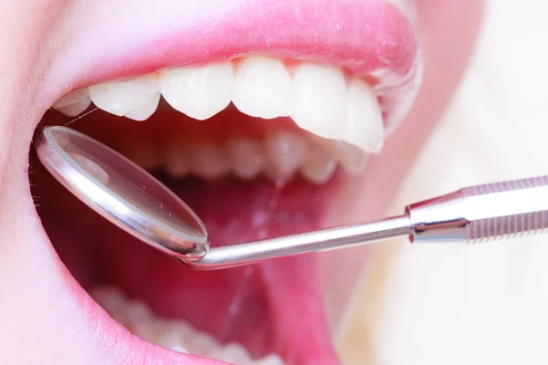 Dental Care Closeup Young Female Having Her Teeth Examinated Healthy — Stock Photo, Image