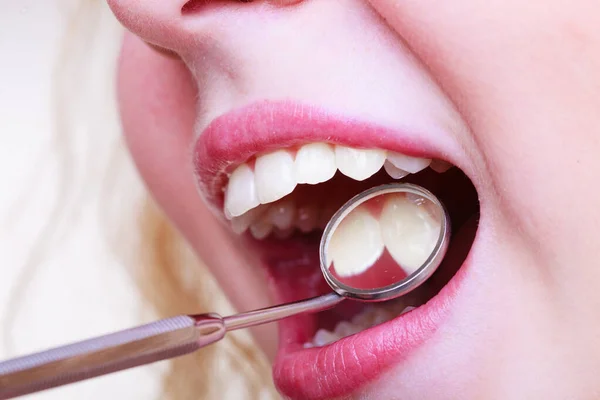 Cuidado Dental Primer Plano Joven Hembra Que Tiene Sus Dientes — Foto de Stock